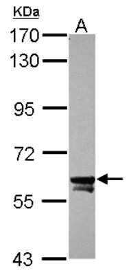 Western Blot: TOE1 Antibody [NBP2-20678] - Sample (30 ug of whole cell lysate) A: HCT116 7. 5% SDS PAGE gel, diluted at 1:1000.