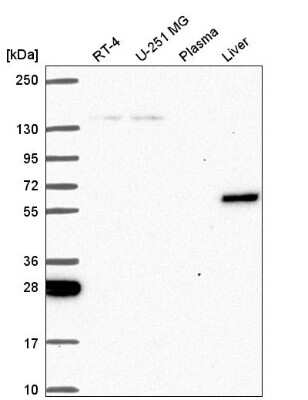 Western Blot: TOE1 Antibody [NBP2-56752] - Western blot analysis in human cell line RT-4, human cell line U-251 MG, human plasma and human liver tissue.