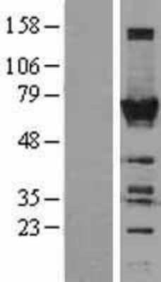 Western Blot: TOE1 Overexpression Lysate (Adult Normal) [NBL1-17187] Left-Empty vector transfected control cell lysate (HEK293 cell lysate); Right -Over-expression Lysate for TOE1.