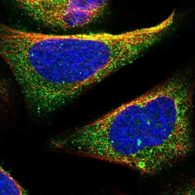 Immunocytochemistry/Immunofluorescence: TOM1 Antibody [NBP2-55152] - Staining of human cell line U-2 OS shows localization to cytosol.