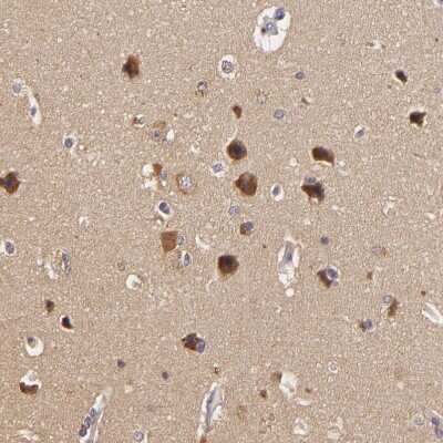 Immunohistochemistry-Paraffin: TOM1 Antibody [NBP1-86170] - Staining of human cerebral cortex shows strong cytoplasmic positivity in neurons.