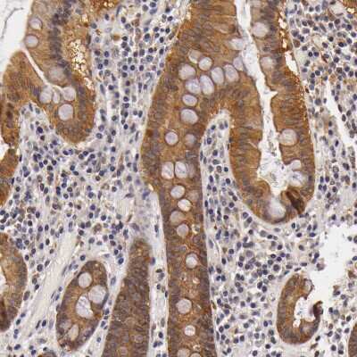 Immunohistochemistry-Paraffin: TOM1 Antibody [NBP1-86170] - Staining of human gastrointestinal shows moderate cytoplasmic positivity in glandular cells.