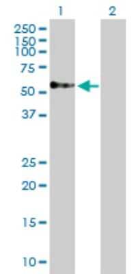 Western Blot: TOM1 Antibody [H00010043-D01P] - Analysis of TOM1 expression in transfected 293T cell line by TOM1 polyclonal antibody.Lane 1: TOM1 transfected lysate(53.80 KDa).Lane 2: Non-transfected lysate.