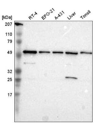 Western Blot: TOM1 Antibody [NBP2-55152] - Western blot analysis in human cell line RT-4, human cell line EFO-21, human cell line A-431, human liver tissue and human tonsil tissue.