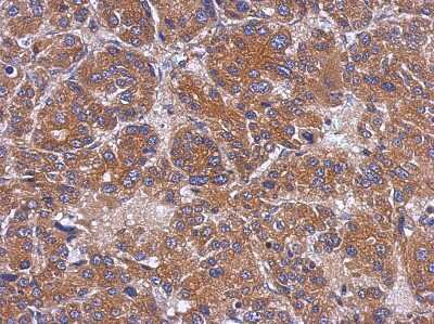 Immunohistochemistry-Paraffin TOM1L1 Antibody