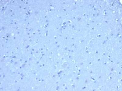 Immunohistochemistry-Paraffin: TOM1L1 Antibody (TOM1L1/4690) - Azide and BSA Free [NBP3-08878] - IHC analysis of formalin-fixed, paraffin-embedded human brain. Negative tissue control using TOM1L1 (TOM1L1/4690) at 2ug/ml in PBS for 30min RT. HIER: Tris/EDTA, pH9.0, 45min. 2 : HRP-polymer, 30min. DAB, 5min.