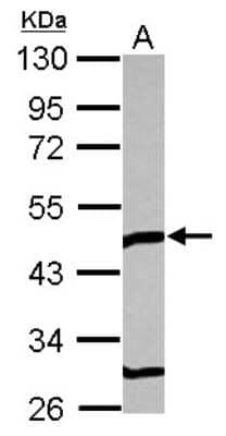 Western Blot TOM1L1 Antibody