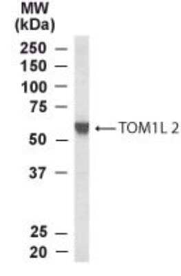 Western Blot TOM1L2 Antibody