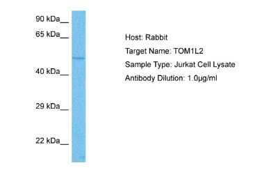 Western Blot: TOM1L2 Antibody [NBP2-88447] - Host: Rabbit. Target Name: TOM1L2. Sample Tissue: Human Jurkat Whole Cell lysates. Antibody Dilution: 1ug/ml