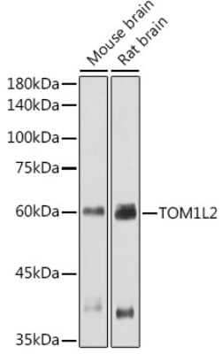 Western Blot: TOM1L2 Antibody [NBP3-16053] - Western blot analysis of extracts of various cell lines, using TOM1L2 antibody (NBP3-16053) at 1:1000 dilution. Secondary antibody: HRP Goat Anti-Rabbit IgG (H+L) at 1:10000 dilution. Lysates/proteins: 25ug per lane. Blocking buffer: 3% nonfat dry milk in TBST. Detection: ECL Basic Kit. Exposure time: 30s.