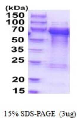 SDS-PAGE Recombinant Human TOM1L2 His Protein