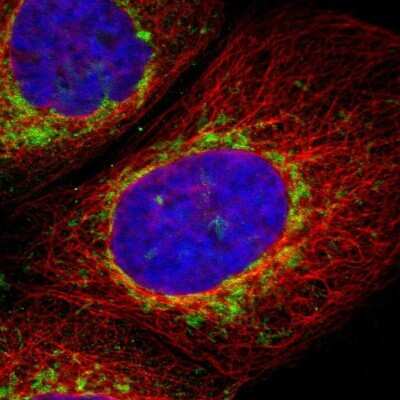 Immunocytochemistry/Immunofluorescence: TOM70 Antibody [NBP1-87863] - Immunofluorescent staining of human cell line A-431 shows localization to mitochondria.