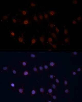 Immunocytochemistry/Immunofluorescence: TOM70 Antibody [NBP2-94889] - Analysis of C6 cells using TOM70 at dilution of 1:100. Blue: DAPI for nuclear staining.