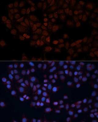 Immunocytochemistry/Immunofluorescence: TOM70 Antibody [NBP2-94889] - Analysis of HeLa cells using TOM70 at dilution of 1:100. Blue: DAPI for nuclear staining.