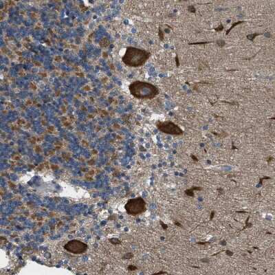 Immunohistochemistry-Paraffin: TOM70 Antibody [NBP1-87863] - Staining of human Cerebellum shows strong granular cytoplasmic positivity in Purkinje cells.