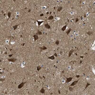 Immunohistochemistry-Paraffin: TOM70 Antibody [NBP1-87863] - Staining of human Cerebral cortex shows strong granular cytoplasmic positivity in neuronal cells.