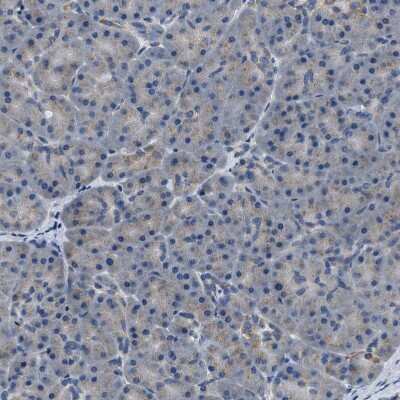 Immunohistochemistry-Paraffin: TOM70 Antibody [NBP1-87863] - Staining of human Pancreas shows very weak granular cytoplasmic positivity in exocrine glandular cells.