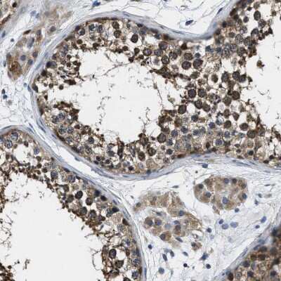 Immunohistochemistry-Paraffin: TOM70 Antibody [NBP1-87863] - Staining of human Testis shows moderate granular cytoplasmic positivity in cells in seminiferous ducts and Leydig cells.