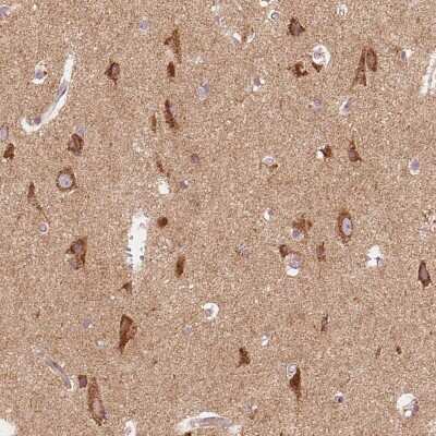 Immunohistochemistry-Paraffin: TOM70 Antibody [NBP2-38571] - Staining of human cerebral cortex shows moderate positivity in neuronal cells.