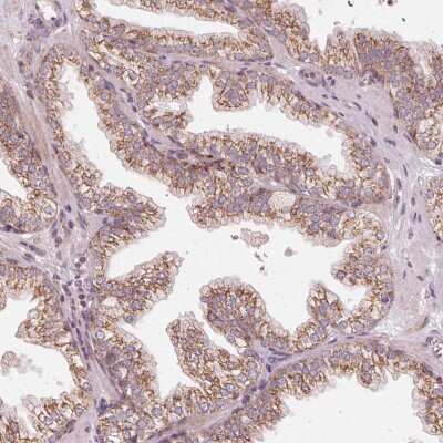 Immunohistochemistry-Paraffin: TOM70 Antibody [NBP2-38571] - Staining of human prostate shows moderate granular cytoplasmic positivity in glandular cells.