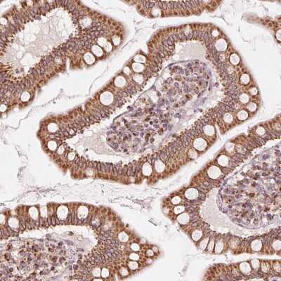 Immunohistochemistry-Paraffin: TOM70 Antibody [NBP2-38571] - Staining of human small intestine shows moderate positivity in glandular cells.