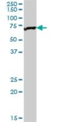 Western Blot: TOM70 Antibody [H00009868-B01P] - Analysis of TOMM70A expression in human liver.