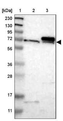 Western Blot: TOM70 Antibody [NBP1-87863] - Lane 1: Marker  [kDa] 230, 130, 95, 72, 56, 36, 28, 17, 11.  Lane 2: Human cell line RT-4.  Lane 3: Human cell line U-251MG sp