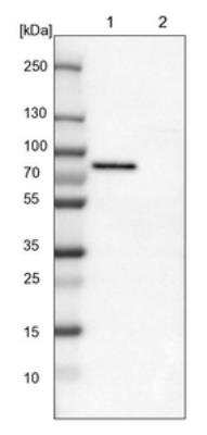 Western Blot: TOM70 Antibody [NBP1-87863] - Lane 1: NIH-3T3 cell lysate (Mouse embryonic fibroblast cells). Lane 2: NBT-II cell lysate (Rat Wistar bladder tumor cells).