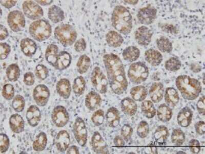 Immunohistochemistry-Paraffin: TOMM20 Antibody (4F3) [H00009804-M01] - Analysis of monoclonal antibody to TOMM20 on formalin-fixed paraffin-embedded human small Intestine. Antibody concentration 3 ug/ml.