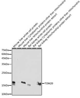 Western Blot: TOMM20 Antibody (6E0N2) [NBP3-15750] - Western blot analysis of extracts of various cell lines, using TOMM20 antibody (NBP3-15750) at 1:5000 dilution. Secondary antibody: HRP Goat Anti-Rabbit IgG (H+L) at 1:10000 dilution. Lysates/proteins: 25ug per lane. Blocking buffer: 3% nonfat dry milk in TBST. Detection: ECL Basic Kit. Exposure time: 10s.