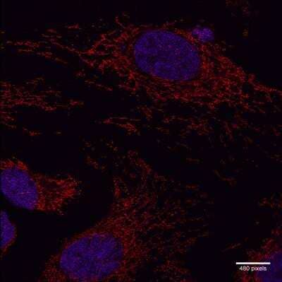 Immunocytochemistry/Immunofluorescence: TOMM20 Antibody [NBP1-81556] - Z-stack confocal images with SRRF (super-resolution radial fluctuations) analysis of Tomm20, an outer mitochondrial membrane protein, in HeLa cells. Tomm20 was detected in HeLa cells using 1 ug/ml Rb anti-Tomm20 (NBP1-81556) and 1:500 JF646-conjugated anti-Rb secondary antibody (red). Cells were counterstained with Dapi (blue). Image submitted by a verified customer review.