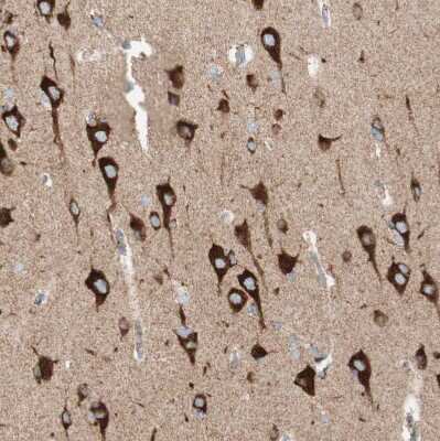 Immunohistochemistry-Paraffin: TOMM20 Antibody [NBP1-81556] - Staining of human cerebral cortex shows moderate to strong positivity in mitochondria in neurons.