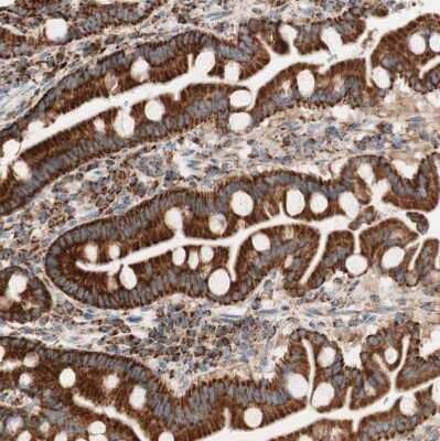 Immunohistochemistry-Paraffin: TOMM20 Antibody [NBP1-81556] - Staining of human duodenum shows moderate to strong positivity in mitochondria in glandular cells.