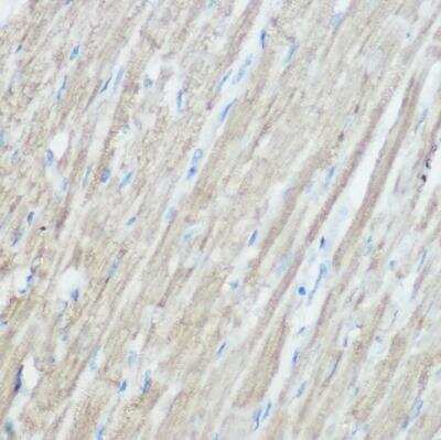Immunohistochemistry-Paraffin: TOMM20 Antibody [NBP2-94821] -  Mouse heart using [KO Validated] TOM20 Rabbit pAb at dilution of 1:100 (40x lens).Perform high pressure antigen retrieval with 10 mM citrate buffer pH 6.0 before commencing with IHC staining protocol.