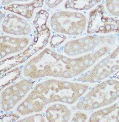 Immunohistochemistry-Paraffin: TOMM20 Antibody [NBP2-94821] - Rat kidney using [KO Validated] TOM20 Rabbit pAb at dilution of 1:100 (40x lens).Perform high pressure antigen retrieval with 10 mM citrate buffer pH 6.0 before commencing with IHC staining protocol.