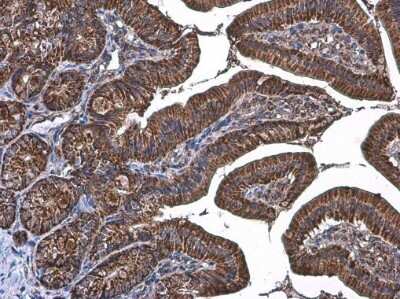 Immunohistochemistry-Paraffin: TOMM20 Antibody [NBP3-13287] - TOMM20 antibody detects TOMM20 protein at mitochondria by immunohistochemical analysis. Sample: Paraffin-embedded mouse duodenum. TOMM20 stained by TOMM20 antibody (NBP3-13287) diluted at 1:500. Antigen Retrieval: Citrate buffer, pH 6.0, 15 min