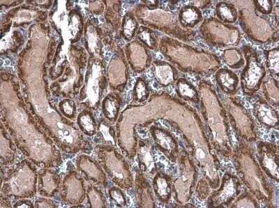 Immunohistochemistry-Paraffin: TOMM20 Antibody [NBP3-13287] - TOMM20 antibody detects TOMM20 protein at mitochondria by immunohistochemical analysis. Sample: Paraffin-embedded rat kidney. TOMM20 stained by TOMM20 antibody (NBP3-13287) diluted at 1:500. Antigen Retrieval: Citrate buffer, pH 6.0, 15 min