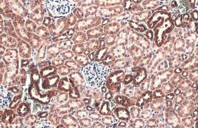 <b>Independent Antibodies Validation. </b>Immunohistochemistry-Paraffin: TOMM20 Antibody [NBP3-13287] - TOMM20 antibody detects TOMM20 protein at mitochondria by immunohistochemical analysis. Sample: Paraffin-embedded mouse kidney. TOMM20 stained by TOMM20 antibody (NBP3-13287) diluted at 1:500. Antigen Retrieval: Citrate buffer, pH 6.0, 15 min