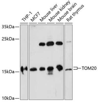 Western Blot: TOMM20 Antibody [NBP2-94821] - Western blot analysis of extracts of various cell lines, using TOMM20 antibody (NBP2-94821) at 1:1000 dilution. Secondary antibody: HRP Goat Anti-Rabbit IgG (H+L) at 1:10000 dilution. Lysates/proteins: 25ug per lane. Blocking buffer: 3% nonfat dry milk in TBST. Detection: ECL Basic Kit. Exposure time: 5min.
