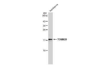 Western Blot: TOMM20 Antibody [NBP3-13287] - Rat tissue extract (50 ug) was separated by 15% SDS-PAGE, and the membrane was blotted with TOMM20 antibody (NBP3-13287) diluted at 1:1000. The HRP-conjugated anti-rabbit IgG antibody (NBP2-19301) was used to detect the primary antibody.