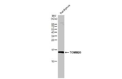 Western Blot: TOMM20 Antibody [NBP3-13287] - Rat tissue extract (50 ug) was separated by 15% SDS-PAGE, and the membrane was blotted with TOMM20 antibody (NBP3-13287) diluted at 1:1000. The HRP-conjugated anti-rabbit IgG antibody (NBP2-19301) was used to detect the primary antibody.