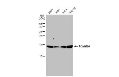 Western Blot: TOMM20 Antibody [NBP3-13287] - Various whole cell extracts (30 ug) were separated by 15% SDS-PAGE, and the membrane was blotted with TOMM20 antibody (NBP3-13287) diluted at 1:1000. The HRP-conjugated anti-rabbit IgG antibody (NBP2-19301) was used to detect the primary antibody.