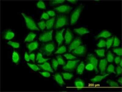 Immunocytochemistry/Immunofluorescence: TOMM22 Antibody (4G4) [H00056993-M01] - Analysis of monoclonal antibody to TOMM22 on HeLa cell. Antibody concentration 10 ug/ml.