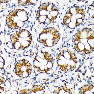 Immunohistochemistry-Paraffin: TOMM22 Antibody (6R1L7) [NBP3-16856] - Immunohistochemistry of paraffin-embedded human colon using TOMM22 Rabbit mAb (NBP3-16856) at dilution of 1:100 (40x lens).Perform microwave antigen retrieval with 10 mM Tris/EDTA buffer pH 9.0 before commencing with IHC staining protocol.