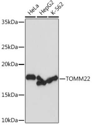 Western Blot: TOMM22 Antibody (6R1L7) [NBP3-16856] - Western blot analysis of extracts of various cell lines, using TOMM22 Rabbit mAb (NBP3-16856) at 1:1000 dilution. Secondary antibody: HRP Goat Anti-Rabbit IgG (H+L) at 1:10000 dilution. Lysates/proteins: 25ug per lane. Blocking buffer: 3% nonfat dry milk in TBST. Detection: ECL Basic Kit. Exposure time: 1s.