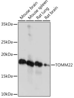 Western Blot: TOMM22 Antibody (6R1L7) [NBP3-16856] - Western blot analysis of extracts of various cell lines, using TOMM22 Rabbit mAb (NBP3-16856) at 1:1000 dilution. Secondary antibody: HRP Goat Anti-Rabbit IgG (H+L) at 1:10000 dilution. Lysates/proteins: 25ug per lane. Blocking buffer: 3% nonfat dry milk in TBST. Detection: ECL Enhanced Kit. Exposure time: 3min.