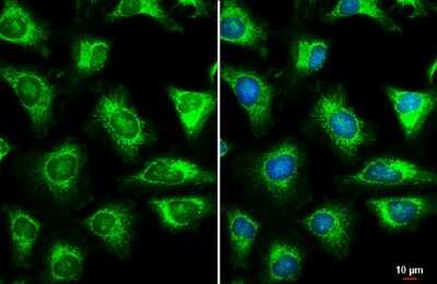 Immunocytochemistry/Immunofluorescence: TOMM22 Antibody [NBP3-13415] - TOMM22 antibody detects TOMM22 protein at mitochondria by immunofluorescent analysis. Sample: HeLa cells were fixed in ice-cold MeOH for 5 min. Green: TOMM22 stained by TOMM22 antibody (NBP3-13415) diluted at 1:500. Blue: Hoechst 33342 staining. Scale bar= 10 um.