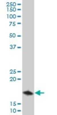 Western Blot: TOMM22 Antibody [H00056993-A01] - Analysis of TOMM22 expression in A-431 (Cat # L015V1).