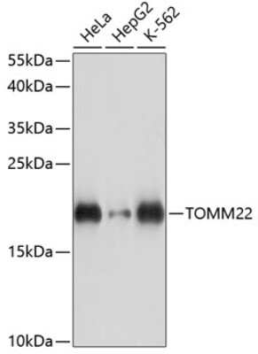 Western Blot: TOMM22 Antibody [NBP2-93620] - Analysis of extracts of various cell lines, using TOMM22 at 1:3000 dilution. Secondary antibody: HRP Goat Anti-Rabbit IgG (H+L) at 1:10000 dilution. Lysates/proteins: 25ug per lane. Blocking buffer: 3% nonfat dry milk in TBST. Detection: ECL Basic Kit . Exposure time: 10s.