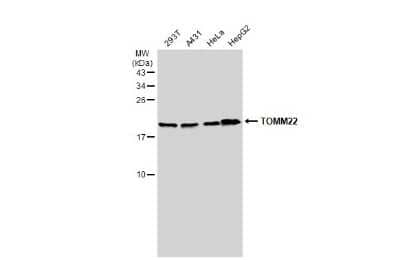 Western Blot: TOMM22 Antibody [NBP3-13415] - Various whole cell extracts (30 ug) were separated by 15% SDS-PAGE, and the membrane was blotted with TOMM22 antibody (NBP3-13415) diluted at 1:1000. The HRP-conjugated anti-rabbit IgG antibody (NBP2-19301) was used to detect the primary antibody.